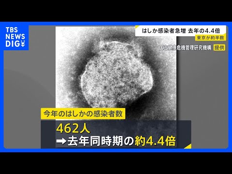 はしか感染者数462人　東京都が半分ほど占める｜TBS NEWS DIG サムネイル