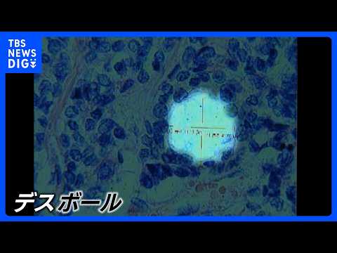 「デスボール」原爆の放射線が体内に留まり細胞に“穴”を　最新の研究発表が波紋…長崎原爆から81年　置き去りの被爆体験者…